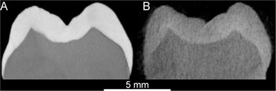 When X-Rays Do Not Work. Characterizing the Internal Structure of Fossil Hominid Dentognathic Remains Using High-Resolution Neutron Microtomographic Imaging